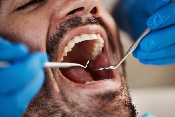 Best Walk-In Emergency Dental Services in Scissors, TX