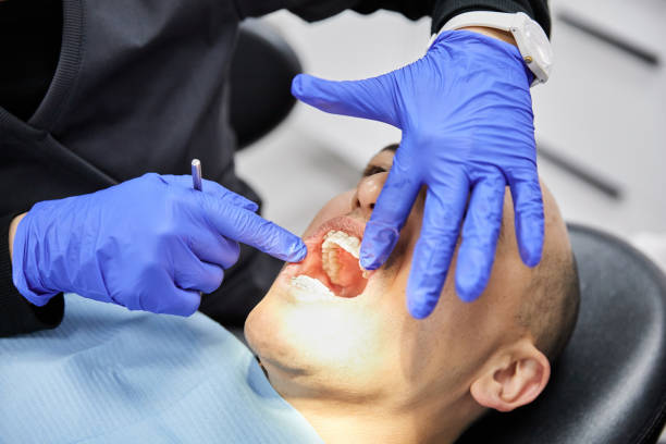 Best Broken or Chipped Tooth Repair in Scissors, TX